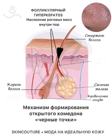 Изображение выглядит как текст, едаКонтент, сгенерированный ИИ, может содержать ошибки.